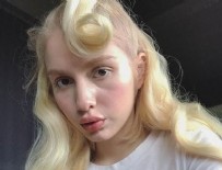 ALEYNA TİLKİ - Aleyna Tilki dudak dolgusu mu yaptırdı?