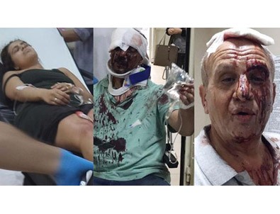 Aksaray'da miras kavgası: 5 yaralı