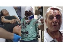 Aksaray'da miras kavgası: 5 yaralı