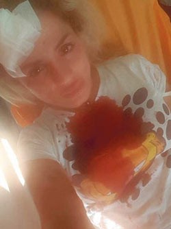 İstanbul'da herkesin önünde şok eden olay! Hastanelik oluncaya kadar...