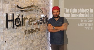 Saç Ekiminde Başarıyı Etkileyen Faktörlere Dikkat !