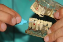 DİŞ FIRÇASI - Et Yedikten Sonra Bunlar Mutlaka Yapılmalı