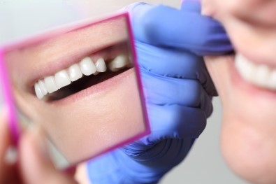 Diş Çekmek Yerine Kanal Tedavisi