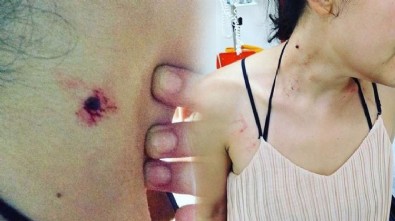 'Müzisyen kadına polis dayağı' haberine açıklama!