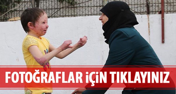 İdlibli Hiba ailesine kavuştu