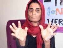KADINA ŞİDDET - 17 yıl işkence gören kadının dramı