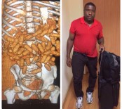 ADDIS ABABA - Göbeğinin şişkinliği dikkat çekti, heyecanlı hareketleri ele verdi