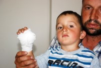 MALATYA İNÖNÜ ÜNIVERSITESI - 3 Yaşındaki Çocuğun Nacakla Kesilen Parmağı Yerine Dikilemedi