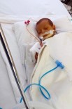 DOKU UYUŞMAZLıĞı - Hatice Nur Bebek Karaciğer Bekliyor