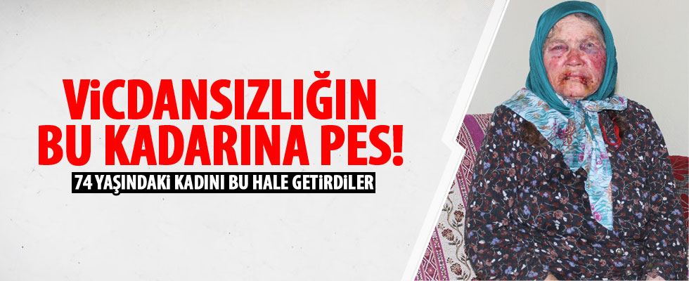 Yaşlı kadını öldüresiye dövdü