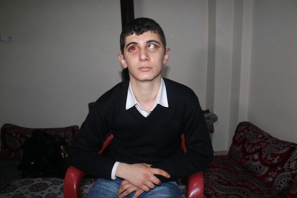 Engelli gence dolmuşta dayak