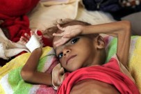 EKONOMIK KRIZ - Yemenli Çocuklar Hayatta Kalmak İçin Üzüm Yaprağı Yiyor