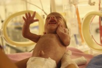 ÇOCUK SAĞLIĞI - Suriye'de Doğan Dördüzler Türkiye'de Yaşama Tutundu