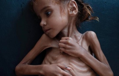 Yemen'de ülke nüfusunun yarısı yardıma muhtaç