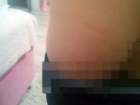 DAYAK - Öğretmenin 6 Yaşındaki Öğrencisini 'Haydar' Sopasıyla Dövdüğü İddiası