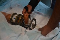DENIZ AKBULUT - Küçük Çocuğun Ayak Bileğindeki Eğrilik Ameliyatla Düzeltildi
