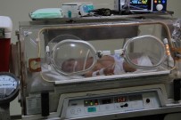 KALP CERRAHI - 800 Gram Doğan Ömer Pusat Bebek 3 Santimetrelik Kesi İle Hayata Tutundu