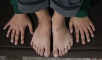 MUSTAFA DEMIRBILEK - 24 Parmaklı Çocuğun Ayakkabı Çilesi