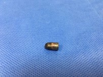 BALISTIK - Kafadaki O Mermi Çıkarıldı