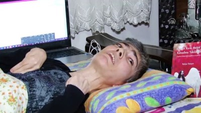 'Kanadı Kırık Melek' Tek Parmağıyla Hayata Tutunuyor