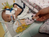 BUSE YILDIRIM - Mete Bebek Hayata Tutunmak İçin Yardım Elini Bekliyor