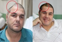 DAMAR TIKANIKLIĞI - İki Fotoğraf Arasında İnanılmaz Fark