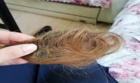 GENÇ KIZ - Hasta Yakını Genç Kızın Sağlık Çalışanını Darp Edip Saçını Kopardığı İddiası