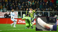 Fenerbahçe Hasan Ali Kaldırım'ın Ayağının Fotoğrafını Paylaştı.