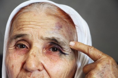 Antalya'da 80 Yaşındaki Kadına Eski Gelininden Sokak Ortasında Dayak İddiası
