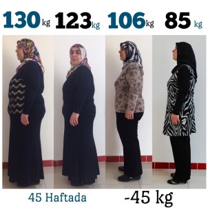 Diyetle 130 Kilodan 85'E Düştü