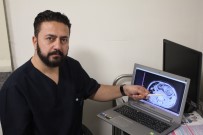 FARABİ HASTANESİ - 12 Yaşındaki Kızın Midesinden Top Büyüklüğünde Saç Ve Sakız Yumağı Çıkarıldı