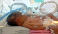 BEYİN KANAMASI - Kafatası Çatlayan 6 Günlük Bebek, Yaşam Savaşı Veriyor