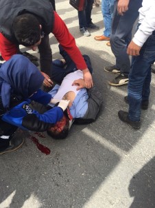 Otomobilin Çarptığı Suriyeli Baba Ve Kızı Ağır Yaralandı