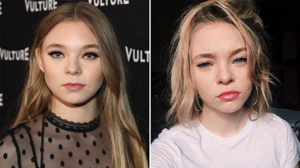 Sette kaza geçiren ünlü oyuncunun yüzünden yaralar oluştu!