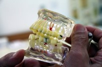 ESTETİK DOLGU - Kırık Dolgu, Diş Kaybına Neden Olabilir