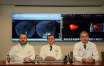 KARACİĞER KANSERİ - Karaciğer kanserinde umut veren uygulama Türkiye'de