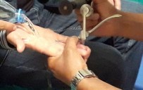 SÜTÇÜ İMAM ÜNIVERSITESI - Parmağa Sıkışan Yüzüğü İtfaiye Çıkardı