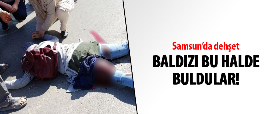 Baldızını sokak ortasında vurdu