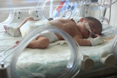Öldürülen Annesinin Karnından Alınan Bebek Erzurum'da Tedavi Altında