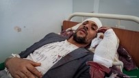 TEMİZLİK İŞÇİSİ - Yemen'de Hava Saldırısında Yaralananlar MSF'nin Desteklediği Hastanelerde Tedavi Ediliyor
