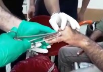 KAHRAMANMARAŞ SÜTÇÜ İMAM ÜNIVERSITESI - Parmağa Sıkışan Yüzük Kesilerek Çıkarıldı