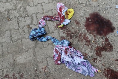 Diyarbakır'da Koca Dehşeti Açıklaması 2 Yaralı