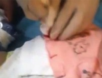 ÇOCUK HASTALIKLARI - Şanlıurfa'da korkunç olay! Hemşire, makasla bebeğin parmağını kesti