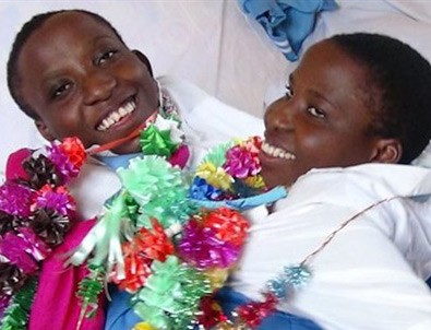 Tanzanya'nın ünlü yapışık ikizleri hayatını kaybetti