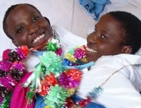 YAPIŞIK İKİZLER - Tanzanya'nın ünlü yapışık ikizleri hayatını kaybetti