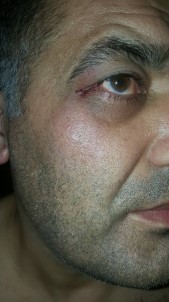 SP Kuşadası İlçe Başkanı Afiş Arbedesinde Yaralandı