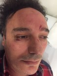 CEVDET ERDÖL - Ümraniye'de Doktora Saldırı