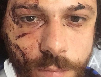 Kadıköy'de oyuncuya şok saldırı! Canını zor kurtardı