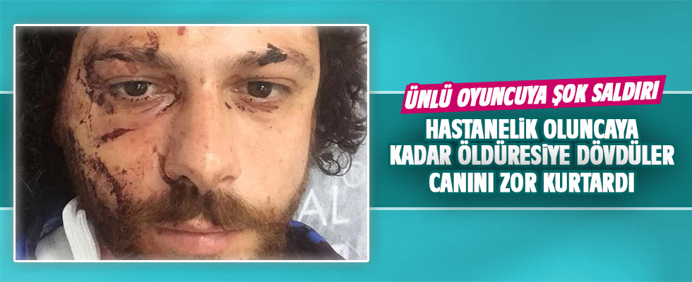 Kadıköy'de oyuncuya şok saldırı! Canını zor kurtardı