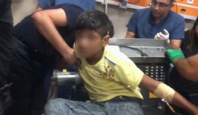 11 Yaşındaki Çocuk Kolunu Et Kıyma Makinesine Kaptırdı